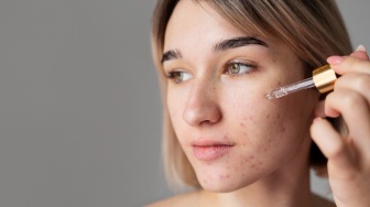 5 Serum yang Ampuh Hempas Bruntusan Sesuai Review Pembeli, Tekstur Kulit Jadi Lebih Halus