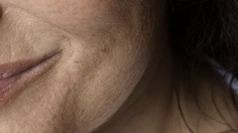 Bagaimana Cara Memilih Serum yang Tepat untuk Kulit Kering? Ini 2 Pilihan Lokal Sesuai Review