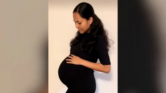 Langka di Dunia, Ibu Ini Lahirkan Bayi Kembar Empat Identik Berjenis Kelamin Perempuan