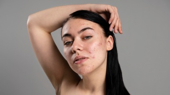 5 Sunscreen Mengandung Salicylic Acid untuk Kulit Berjerawat sesuai Review dan Harga