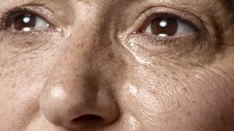 7 Tanda Kulit Rusak Akibat Tidak Memakai Sunscreen secara Rutin