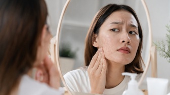 3 Serum Ampuh Basmi Bruntusan dan Noda Hitam Bekas Jerawat, Wajah Mulus Tanpa Bekas