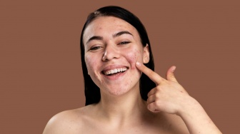 Sunscreen Apa yang Bisa Menghilangkan Jerawat? Ini 6 Rekomendasi Terbaik sesuai Review