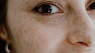 5 Serum Flek Hitam yang Cepat Menyamarkan Noda Hitam di Wajah Sesuai Review