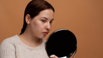 7 Rekomendasi Bedak Mengandung Salicylic Acid dan Centella untuk Kulit Berjerawat