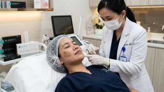Intip Rahasia Skin Booster DNA Salmon yang Ampuh Pudarkan Flek Hitam, Kulit Glowing Tanpa Iritasi