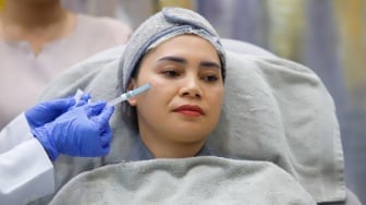 Inovasi Terbaru Kecantikan Wajah, Volulift 2.0 Resmi Diperkenalkan