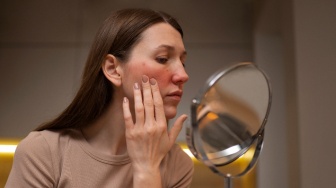 Tak Sama, Ketahui Ciri-Ciri Rosacea serta Bedanya dengan Jerawat Biasa