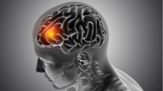 Hati-Hati! 5 Kebiasaan Kecil ini Bisa Bikin Kamu Mengalami Brain Rot