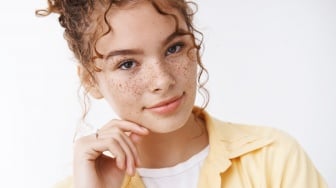 Apakah Freckles di Wajah Bisa Hilang Sendiri atau Butuh Treatment?