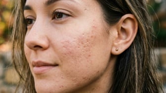 Apakah Serum PDRN DNA Salmon Bisa Membantu Meratakan Tekstur Bekas Jerawat Bopeng?