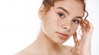Cara Mencegah Bintik Freckles Bertambah Banyak dan Makin Gelap, Sunscreen Berperan Penting