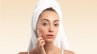 Gak Bikin Iritasi! 5 Invisible Acne Patch yang Aman untuk Kulit Sensitif