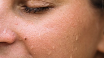 Cara Membedakan Keringat Biasa vs Sunscreen Luntur Saat Cuaca Panas Terik, Cek Tandanya