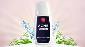Viva Acne Lotion Bisa Buat Bruntusan Tidak? Ini Manfaat dan Kandungannya