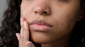 Lipstik Apa yang Bikin Bibir Hitam? Kenali Ciri-Cirinya agar Tak Salah Beli
