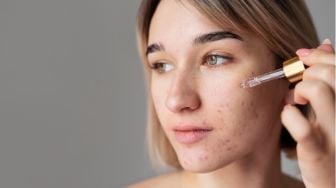 4 Serum Retinal Ampuh untuk Samarkan Dark Spot dan Cegah Penuaan Dini
