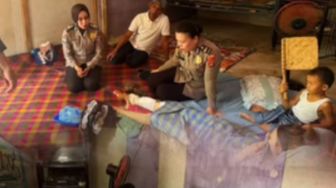 Detik-detik Mencekam Ibu Selamatkan Anak dari Gigitan Buaya di Way Semaka, Kaki Korban Robek 20 Cm
