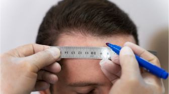 7 Tips Mencegah Garis Rambut atau Hairline Mundur, Hentikan Kebiasaan Mengikat Terlalu Kencang