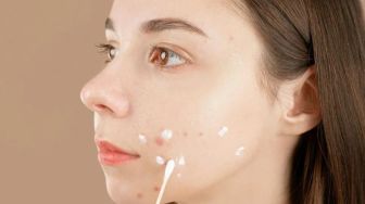 4 Acne Spot Sulfur Solusi Buat Jerawat Auto Cepat Kering dan Kontrol Minyak