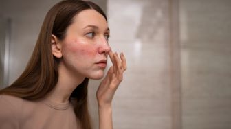 7 Cara Mengatasi Kulit Perih dan Memerah saat Mencoba Krim Retinol agar Iritasi Mereda