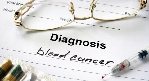 Peluang Hidup Penderita Kanker Darah Tergantung Usia Ini
