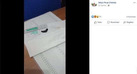 Viral Hidung Bocah Solo Kemasukan Lintah Hati Hati Bahaya Viral Hidung Bocah Solo Kemasukan Lintah Hati Hati Bahaya