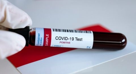 Pemerintah Mulai Terapkan Rapid Test Antigen Untuk Covid 19 Tes Apa Itu