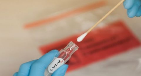 Main ke Rumah Teman Super Taat Prokes, Wajib Tes Swab Dulu, Publik: Sungguh Totalitas