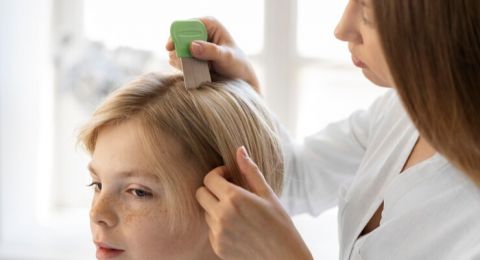 4 Pengobatan Rumahan untuk Menghilangkan Kutu di Rambut, Yuk Coba!
