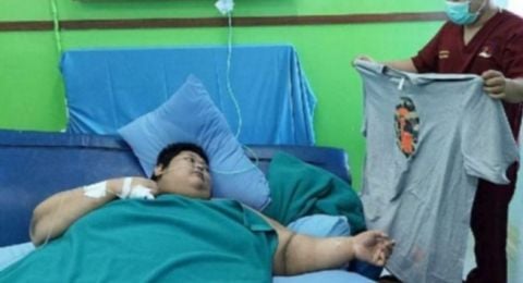 Sempat Alami Syok Septik, Fajri Pengidap Obesitas 300 Kg Dikabarkan Meninggal Dunia