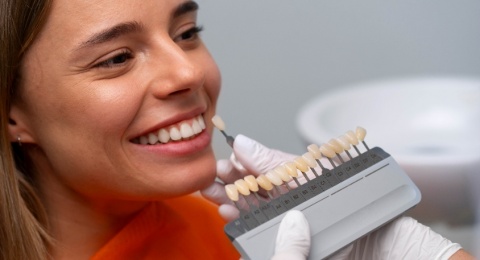 Jangan Sembarangan! Pikirkan 5 Hal Ini sebelum Pasang Veneer Gigi