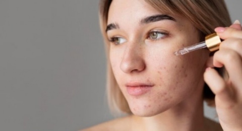 3 Rekomendasi Dark Spot Serum Lokal yang Terbaik, Harga Mulai Rp79 Ribu