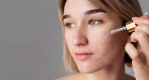 4 Serum yang Mengandung Kojic Acid Terbukti Ampuh Pudarkan Hiperpigmentasi