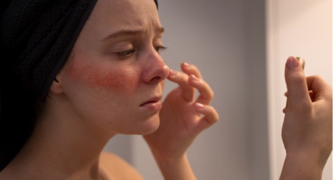 Skincare Berbahan Algae untuk Kulit Sensitif: 4 Produk yang Wajib Dicoba!