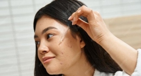 Wajah Muncul Jerawat setelah Lebaran! Ini 4 Acne Serum yang Layak Dicoba