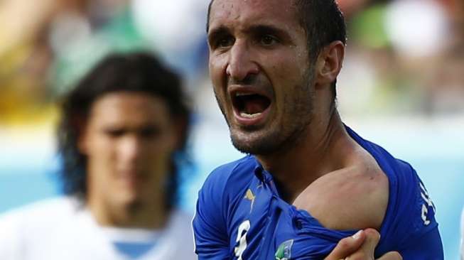 Chiellini: Hukuman kepada Suarez Terlalu Berat