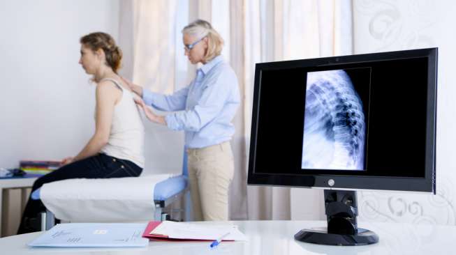 6 Faktor Risiko Osteoporosis yang Wajib Diketahui