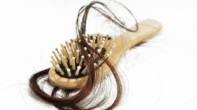 Ilustrasi rambut rontok. (Sumber: Shutterstock)