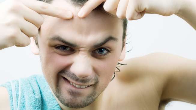 Ilustrasi jerawat pada lelaki. (Sumber: Shutterstock)