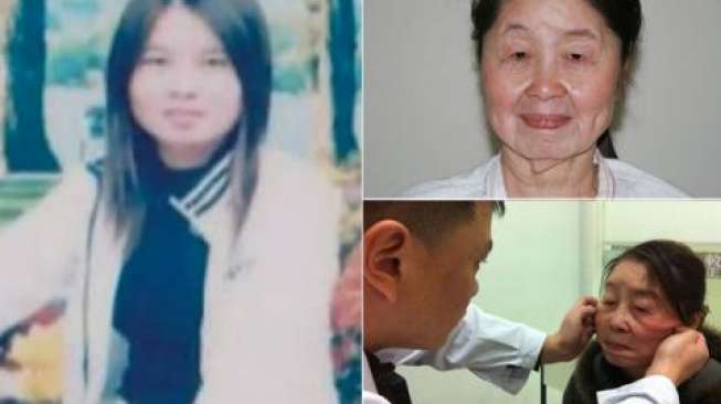 Berusia 29 Tahun, Perempuan Ini Tampak Seperti 80 Tahun