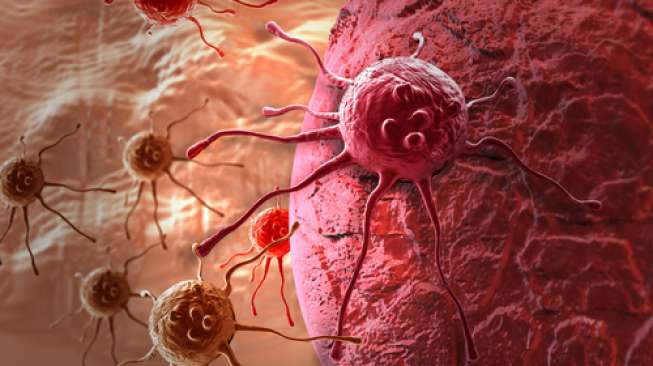 Ilustrasi sel kanker. (Shutterstock)