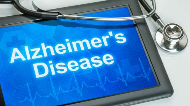 Belum Ada Obat yang Bisa Sembuhkan Alzheimer