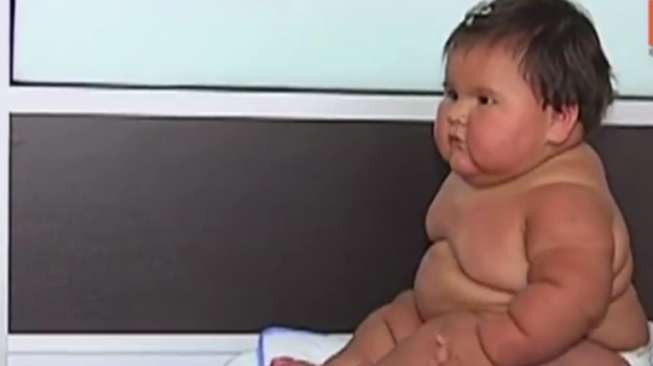 Belum Genap Setahun, Berat Badan Anak-anak Ini Sudah 20Kg