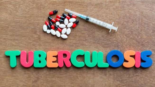 Ilustrasi tuberkulosis. (Shutterstock)