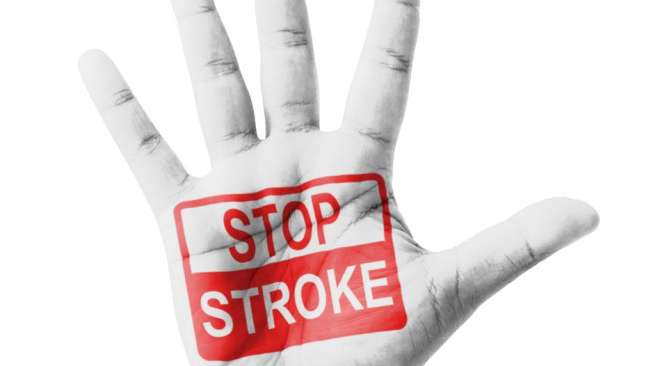 Ilustrasi penyakit stroke. (Shutterstock)