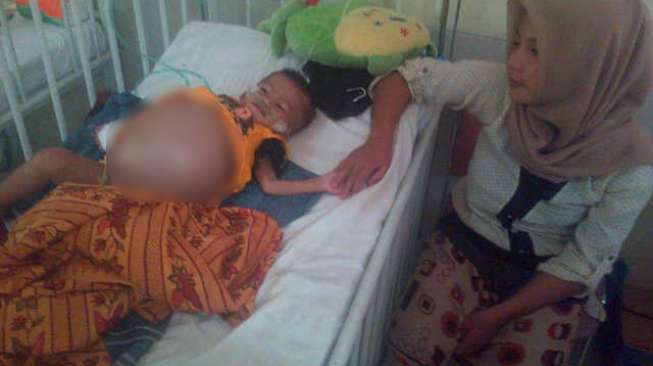 Perutnya Membesar, Bayi Ini Terkena Tumor Ganas