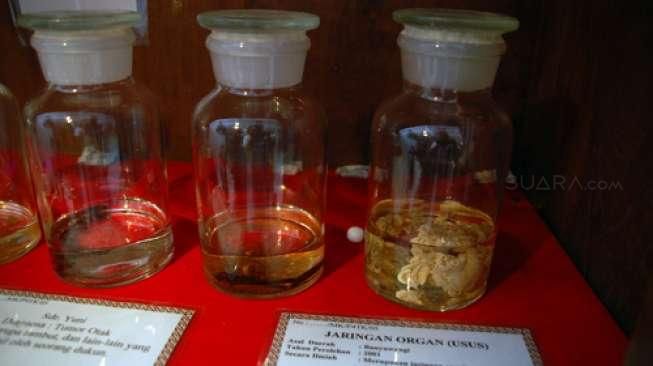 Ingin Melihat Dunia Lain? Datanglah ke Museum Santet Surabaya