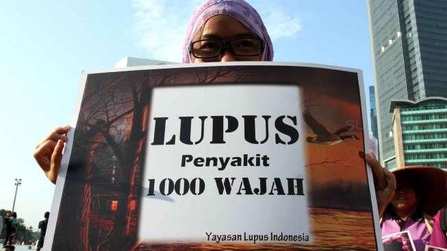 Hari Lupus, Odapus Desak Pemerintah Sediakan Obat "Off Label"