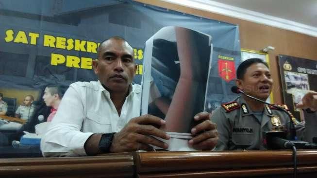 Polisi Tingkatkan Status Ibu Gergaji Anak Sebagai Tersangka